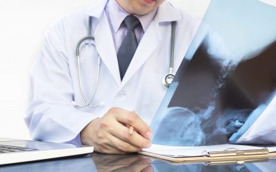 Doctor examine x-ray film over white background